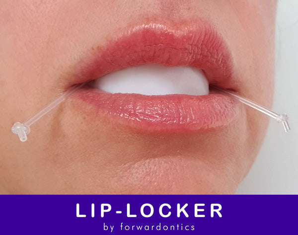 Lip-Locker